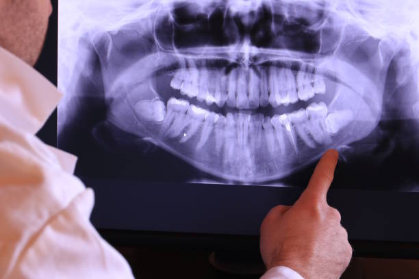 Best Pediatric Emergency Dentist in Roberts, WI