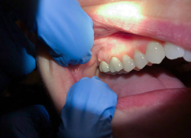 Best Urgent Care for Lost Fillings or Crowns in Roberts, WI