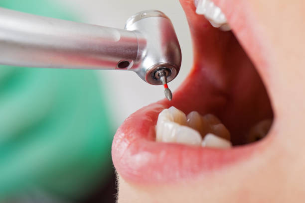 Best Emergency Treatment for Dental Infections or Abscesses in Roberts, WI